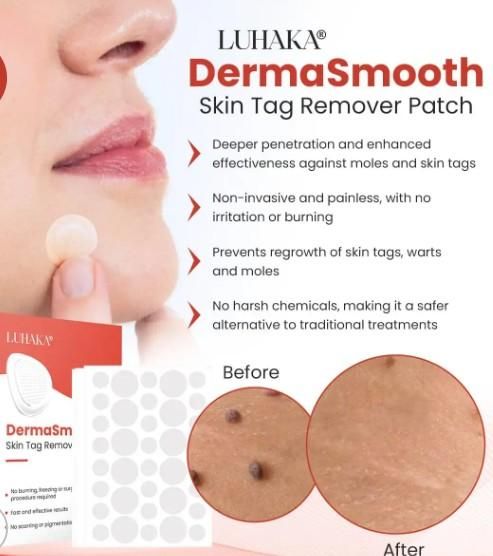 Derma Smooth Skin Tag Removal Patch