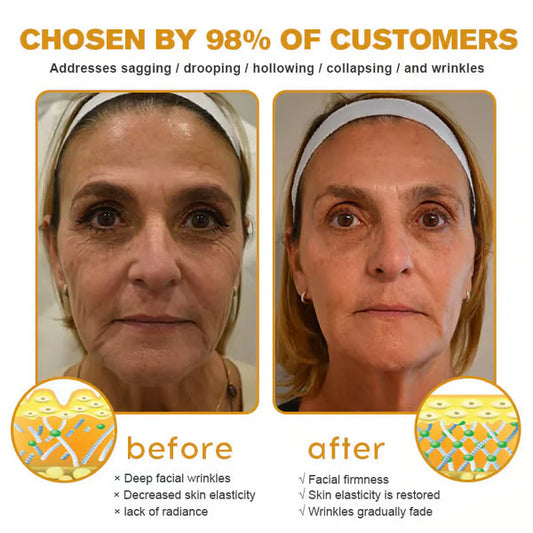 👨⚕️Botox Bee Venom Wrinkle Removal Cream (BUY 1 GET 1 FREE)