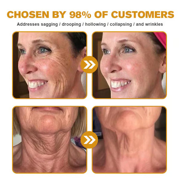 👨⚕️Botox Bee Venom Wrinkle Removal Cream (BUY 1 GET 1 FREE)
