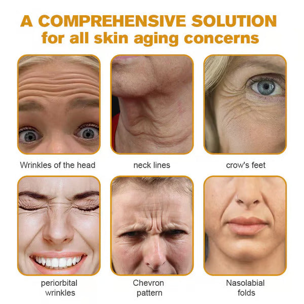👨⚕️Botox Bee Venom Wrinkle Removal Cream (BUY 1 GET 1 FREE)