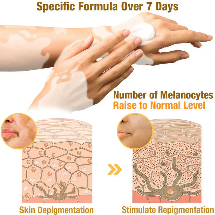 VitiGO Revitalizing Bee Venom Cream – Natural Skin Restoration & Vitality (Buy 1 Get 1 Free🔥)