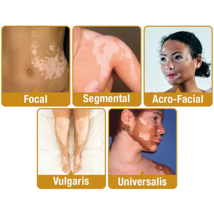VitiGO Revitalizing Bee Venom Cream – Natural Skin Restoration & Vitality (Buy 1 Get 1 Free🔥)