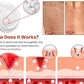 Derma Smooth Skin Tag Removal Patch