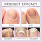 Nail Growth & Repair Serum (BUY 1 GET 1 FREE)